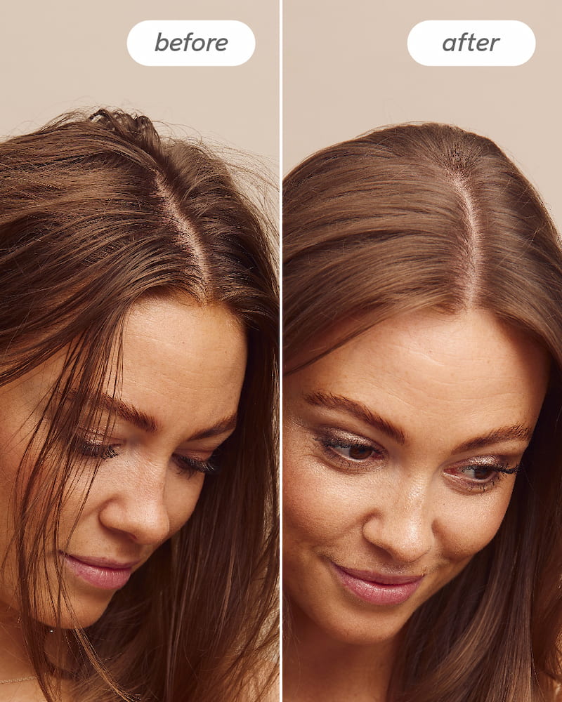 Scalp Delight™ Detox Conditioner - Image 8